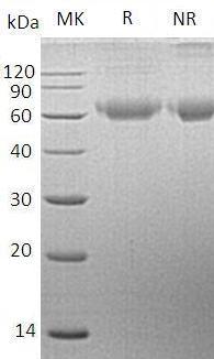 Human SIL1/UNQ545/PRO836 (His tag) recombinant protein