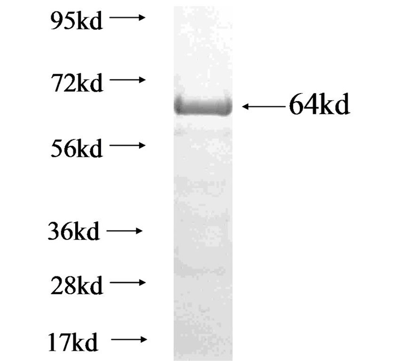 Recombinant human CLIP2 SDS-PAGE