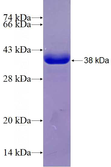 Recombinant Human Integrin beta-6 SDS-PAGE