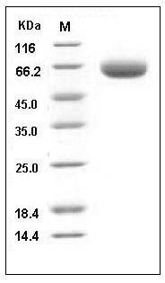 Mouse BACE-1 Protein (His Tag) SDS-PAGE