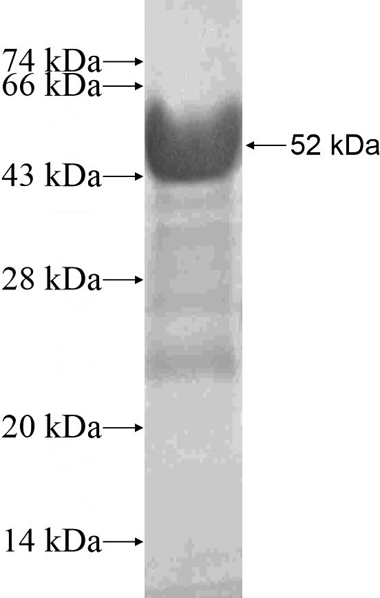Recombinant Human ZNF264 SDS-PAGE