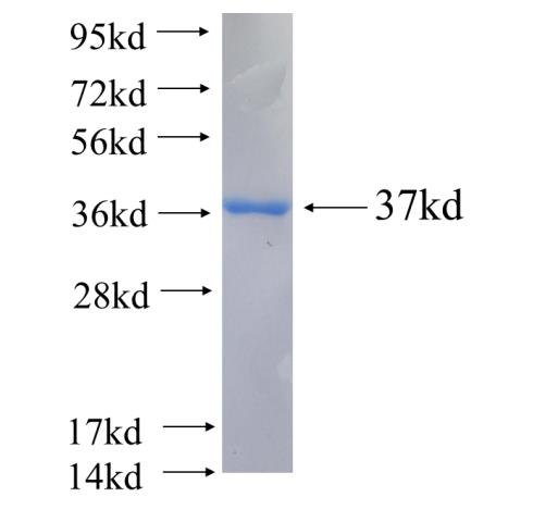 Recombinant human HARS SDS-PAGE