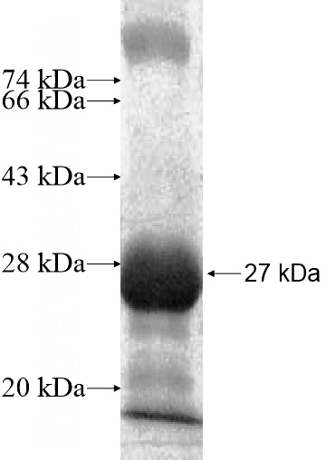 Recombinant Human HLA-DOA SDS-PAGE