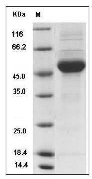 Rat IFN-alpha / IFNA1 / IFN Protein (Fc Tag) SDS-PAGE