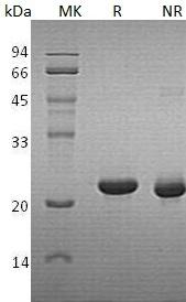 Human CYGB/STAP (His tag) recombinant protein