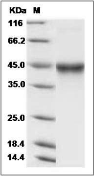 Mouse IL5Ra / CD125 Protein (His Tag) SDS-PAGE