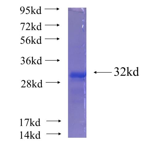 Recombinant human TIRAP SDS-PAGE