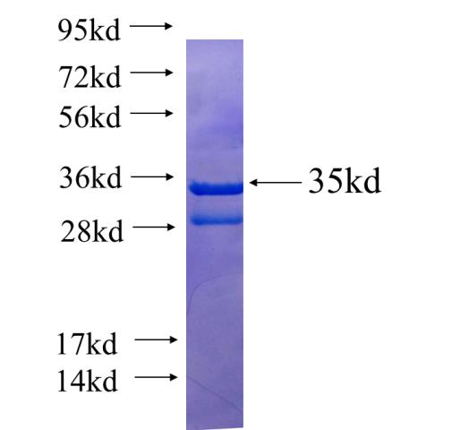Recombinant human MIP SDS-PAGE
