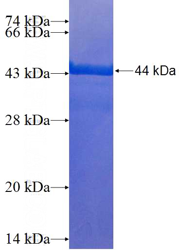 Recombinant Human HOXC13 SDS-PAGE