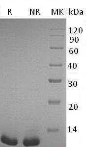 Mouse S100b (His tag) recombinant protein