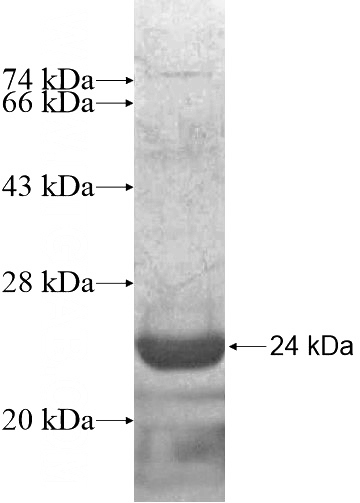 Recombinant Human ASB6 SDS-PAGE