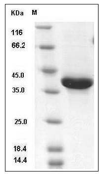 Human NRG1-beta 1 Protein (EGF Domain, Fc Tag) SDS-PAGE