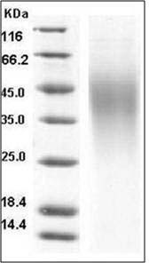 Mouse IL18BP Protein (His Tag) SDS-PAGE