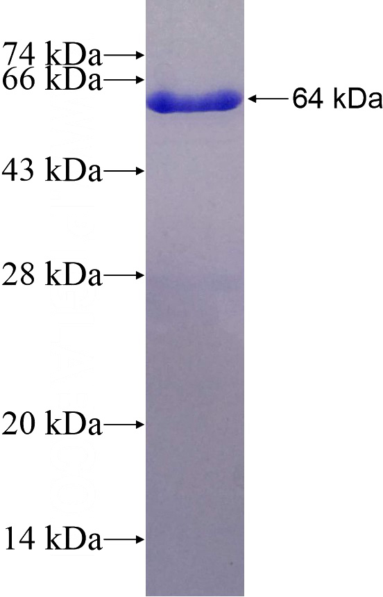 Recombinant Human KLC1 SDS-PAGE