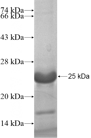 Recombinant Human CDX4 SDS-PAGE