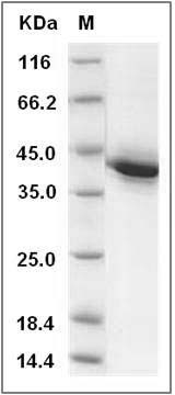 Rat TNFRSF17 / BCMA Protein (Fc Tag) SDS-PAGE
