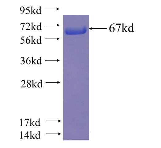 Recombinant human PSMD4 SDS-PAGE