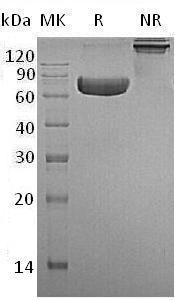 Human TNFRSF1B/TNFBR/TNFR2 (Fc tag) recombinant protein
