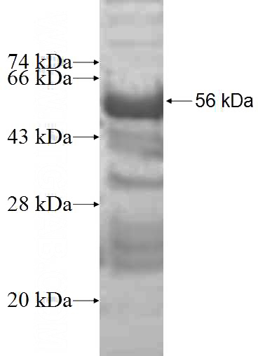 Recombinant Human COPS7A SDS-PAGE