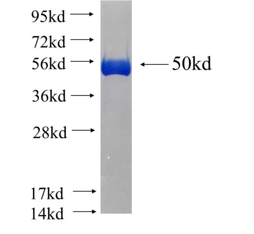 Recombinant human RAB2A(Full length) SDS-PAGE