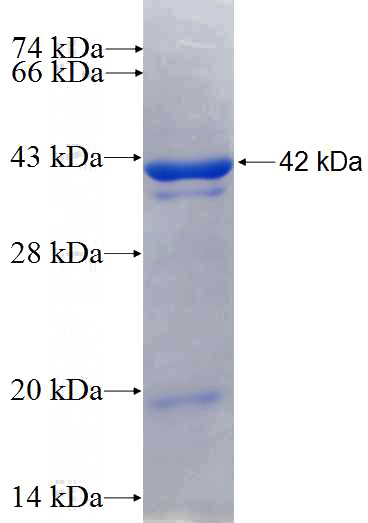 Recombinant Human RHPN1 SDS-PAGE
