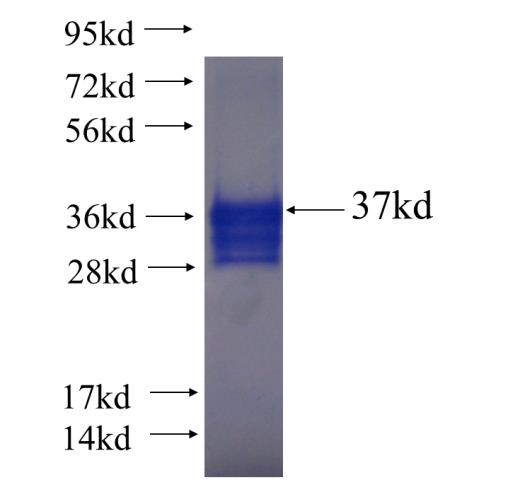 Recombinant human ESRRB SDS-PAGE