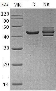 Human CKM/CKMM (His tag) recombinant protein