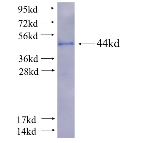 Recombinant human CTNNA2 SDS-PAGE