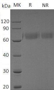Human HYOU1/GRP170/ORP150 (His tag) recombinant protein
