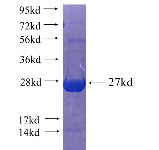 Recombinant human SFMBT2 SDS-PAGE