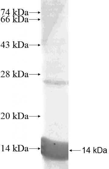Recombinant Human HSD17B13 SDS-PAGE