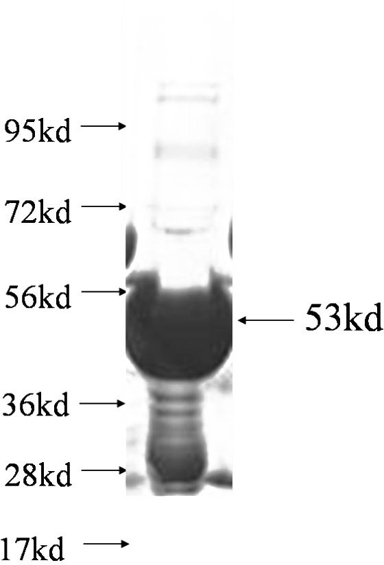Recombinant Human NAT11 SDS-PAGE