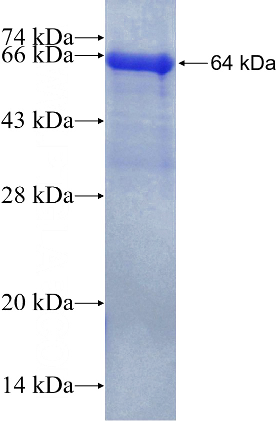 Recombinant Human MUT SDS-PAGE