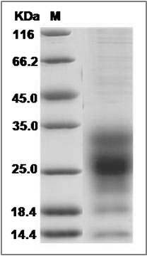 Human TSPAN1 Protein (aa 110-211, His Tag) SDS-PAGE