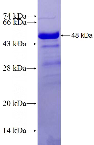 Recombinant Human C19orf26 SDS-PAGE