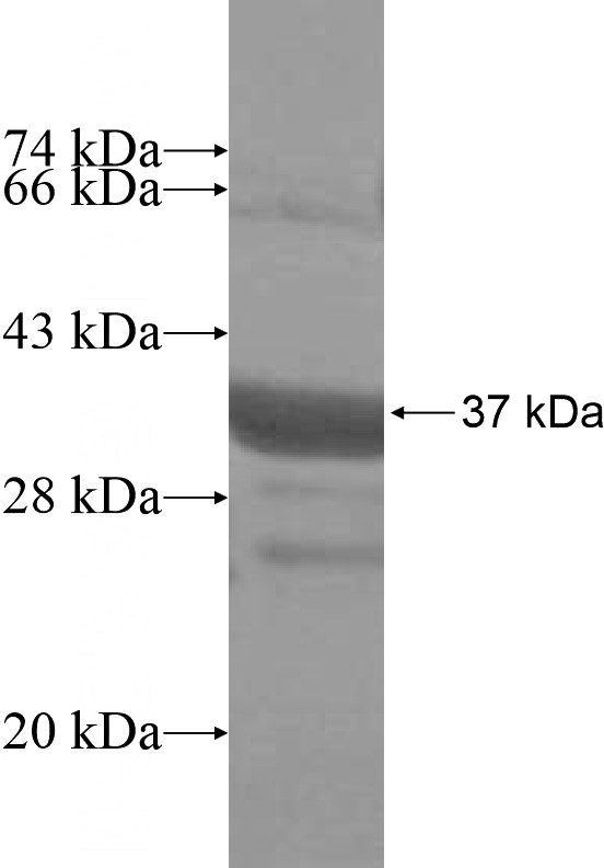 Recombinant Human TLL2 SDS-PAGE