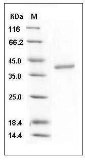 Mouse CTSZ / CTSX / Cathepsin Z Protein (His Tag) SDS-PAGE
