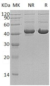 Human ADH7 (His tag) recombinant protein