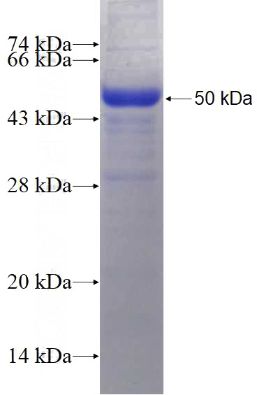 Recombinant Human CALCOCO1 SDS-PAGE