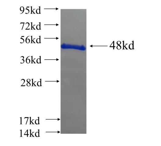 Recombinant human ARMC7 SDS-PAGE