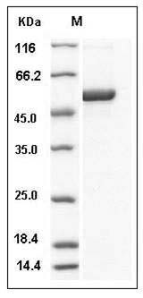 Human S100A3 / S100E Protein (His & MBP Tag) SDS-PAGE