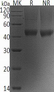 Mouse Dcn (His tag) recombinant protein