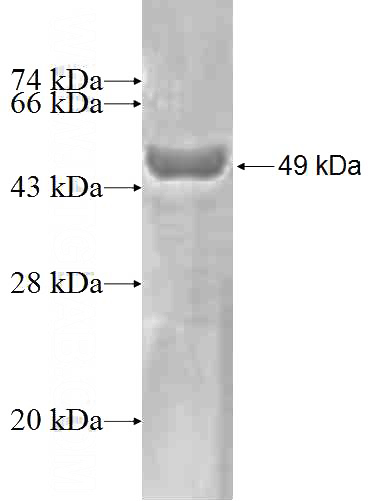 Recombinant Human HEBP2 SDS-PAGE