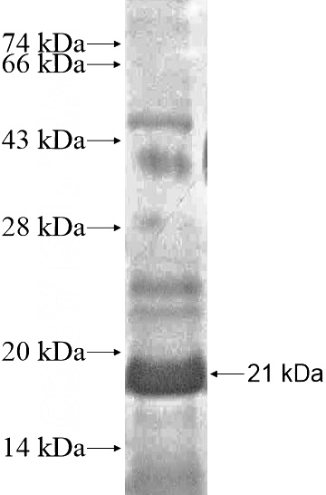 Recombinant Human NAT8L SDS-PAGE