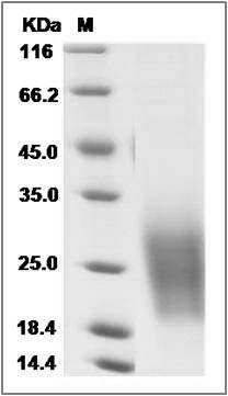 Cynomolgus TALLA-1 / TSPAN7 Protein (His Tag) SDS-PAGE