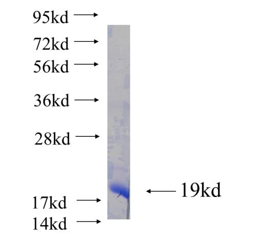 Recombinant human SLC1A2 SDS-PAGE