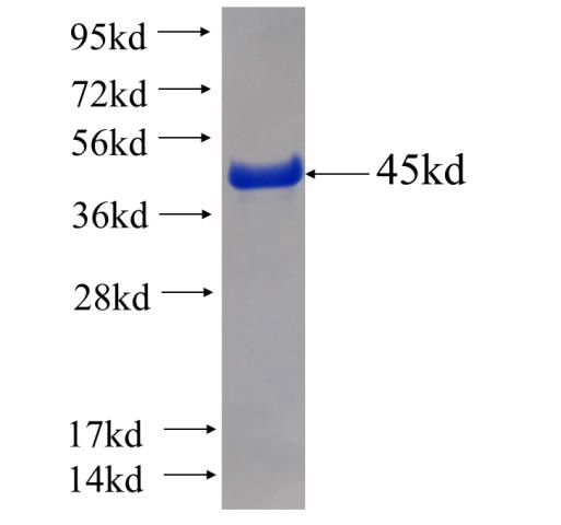 Recombinant human RPS10 SDS-PAGE
