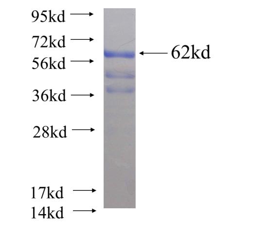 Recombinant human PSMD7 SDS-PAGE
