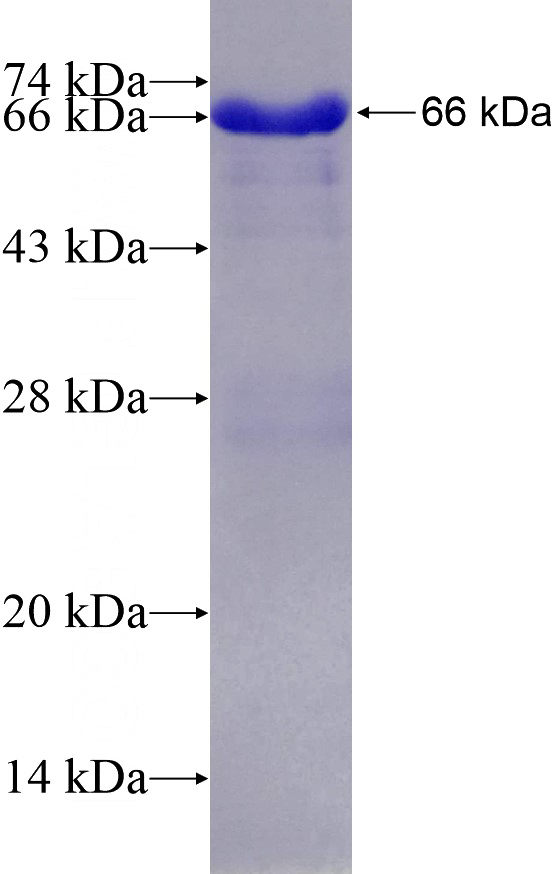 Recombinant Human GRAP2 SDS-PAGE