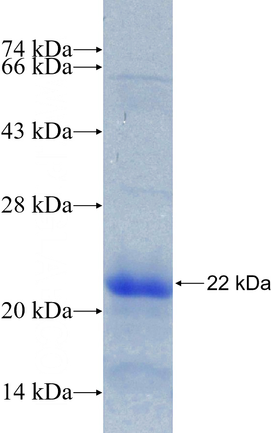 Recombinant Mouse Cdkn1a SDS-PAGE